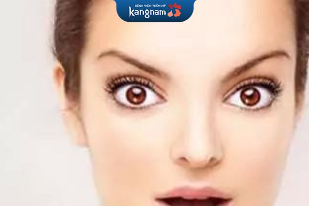 Mắt dê khiến tướng mày sao chổi có vận mệnh kém hơn