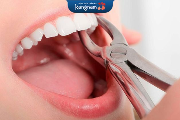 Sau nhổ răng chỉ bị ê buốt nhẹ