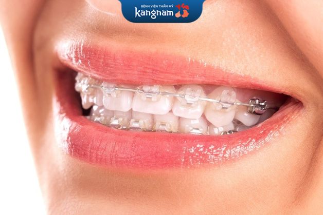 nhiều người ưa chuộng và lựa chọn