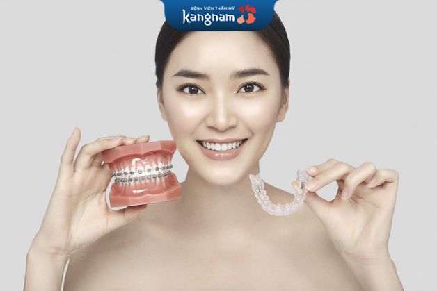 Chỉnh nha tăng thêm thẩm mỹ cho gương mặt