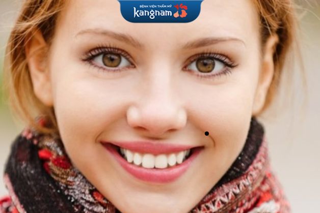 Nốt ruồi đen giữa đường pháp lệnh không tốt cho sức khỏe