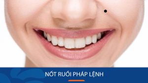Nốt ruồi pháp lệnh: Bí quyết sở hữu tướng số đẹp và vận mệnh tốt