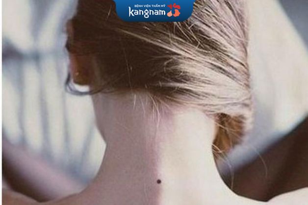 mụn ruồi may mắn, biểu hiện cho người có tướng số tốt