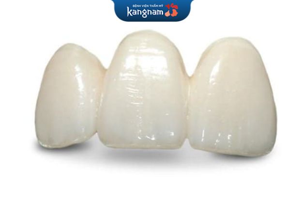 Răng sứ emax giá bao nhiêu