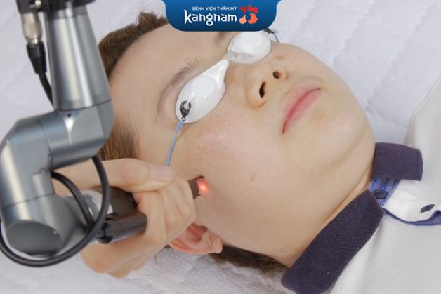Việc áp dụng tia laser công nghệ cao điều trị tận gốc chân mụn đầu đen mang đến hiệu quả nhanh chóng