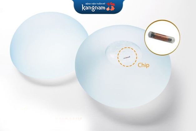 Mô cấy gắn chip vô cùng tiện lợi