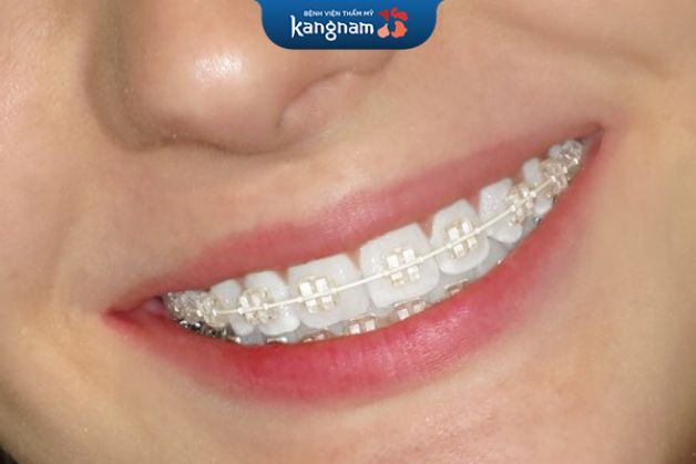 mang hiệu quả tối ưu