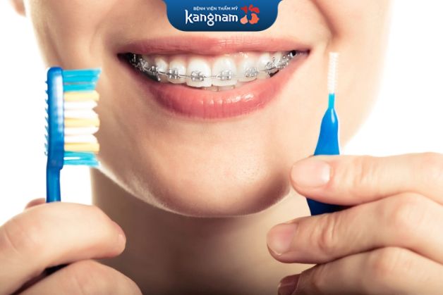 Niềng răng mất bao lâu