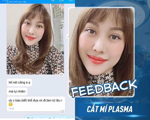 Feedback của khách hàng sau khi cắt mí tại Kangnam 