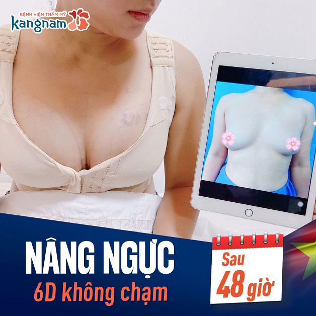Sử dụng áo định hình sau nâng giúp form ngực đạt chuẩn