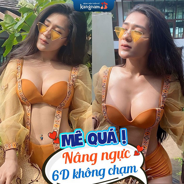 Thay đổi vòng 1 sau khi nâng ngực 6D không chạm