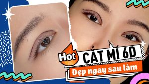 Bật mí bí quyết cắt mí 6D: Đẹp tự nhiên, không sẹo, không bầm