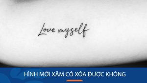 Hình mới xăm có xóa được không? Phương pháp xóa xăm an toàn