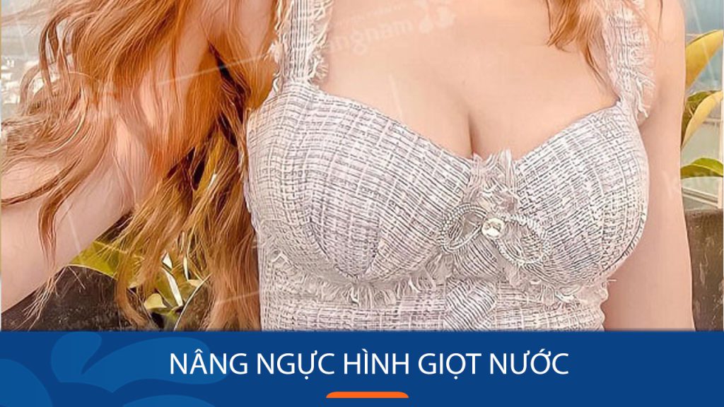 Nâng ngực hình giọt nước: Giải pháp hoàn hảo cho vòng 1