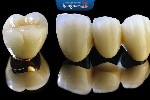 Răng sứ titan sử dụng được bao lâu