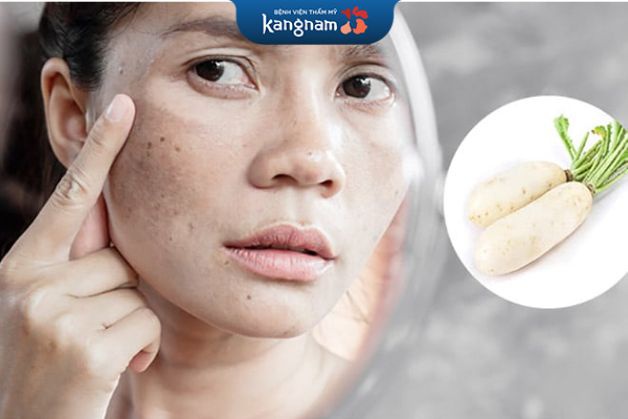 Mặt nạ củ cải giúp làm mờ tàn nhang nhanh chóng