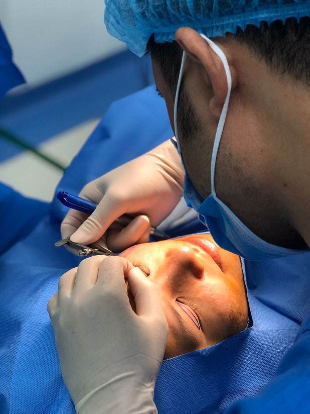 Bác sĩ cắt mí chuyên nghiệp tại Kangnam