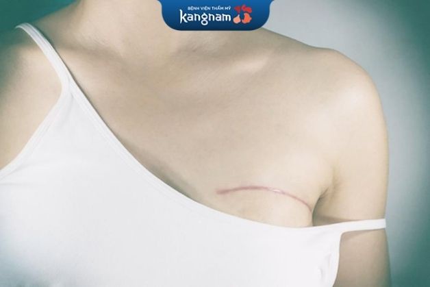 Nâng ngực 6D VIP giá bao nhiêu