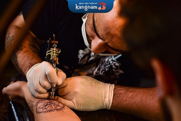 Hình mới xăm có xóa được không