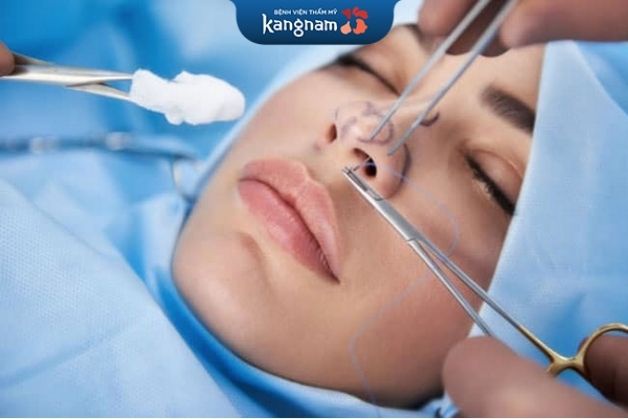 Nâng mũi bằng chỉ Collagen vẫn tiềm ẩn rủi ro