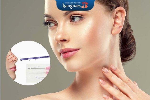 Nâng mũi bằng chỉ khá tốt cho trường hợp mũi ít lệch hỏng