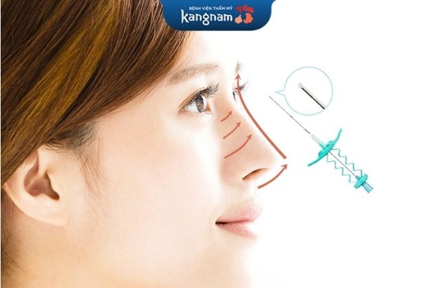 Nâng mũi chỉ Collagen khá nhanh chóng và hiệu quả