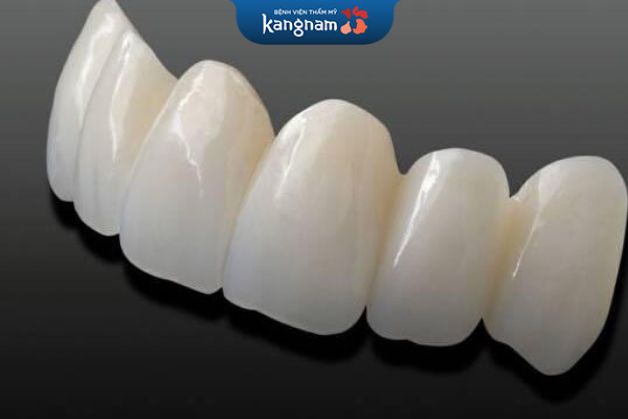 Răng sứ cercon thích ứng sinh học cao với cơ thể