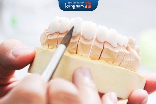 Răng sứ DDBio độ bền cao, màu sắc tự nhiên