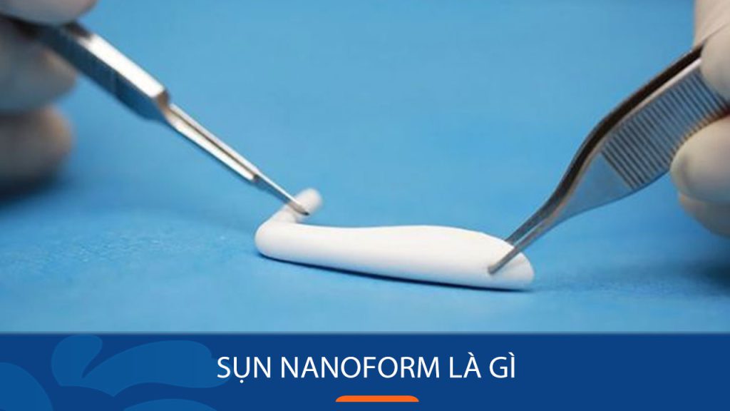 Sụn Nanoform là gì? Đặc điểm, ưu nhược điểm và so sánh với Surgiform