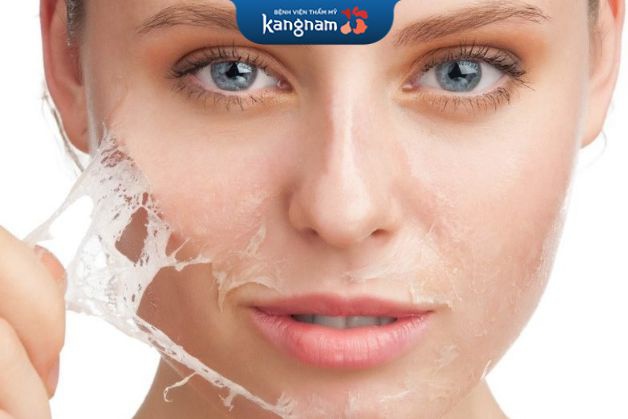 Điều trị đốm nâu tàn nhang