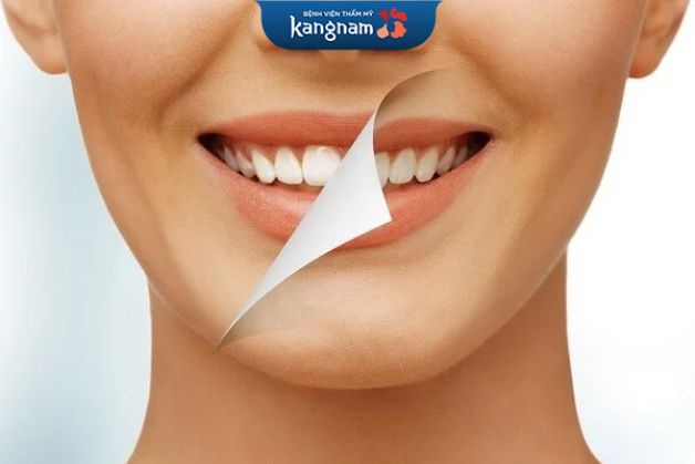 Thay mão sứ mới khắc phục đen viền nướu