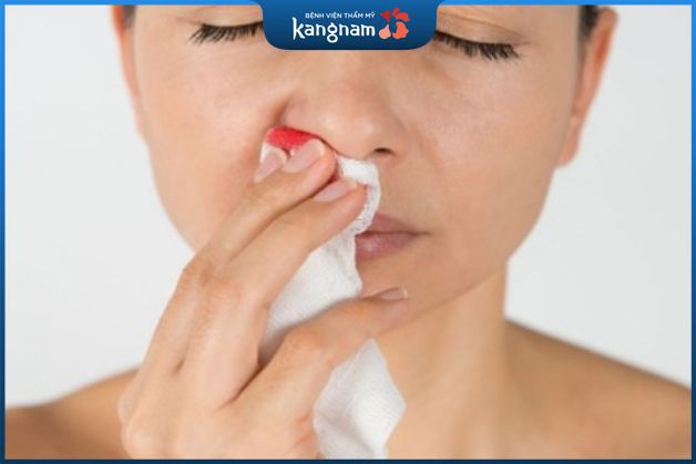 Những biến chứng vách ngăn mũi bị lệch