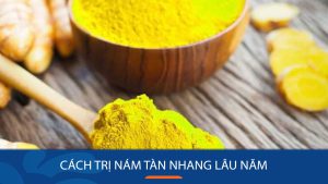 Cách trị nám tàn nhang lâu năm: 15 Công thức hiệu quả