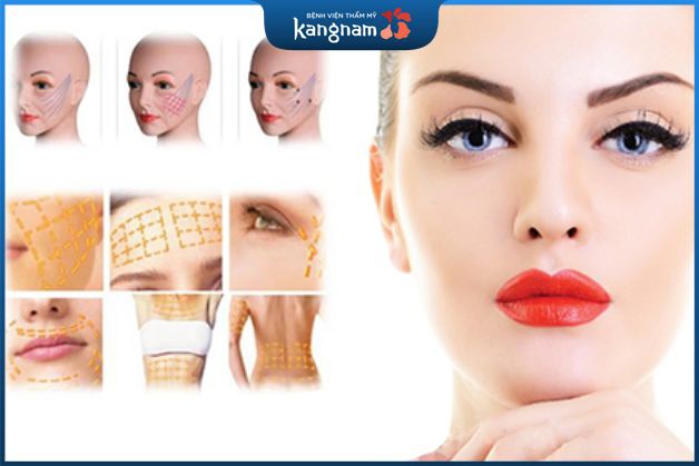 Căng da chỉ vàng có tốt không?