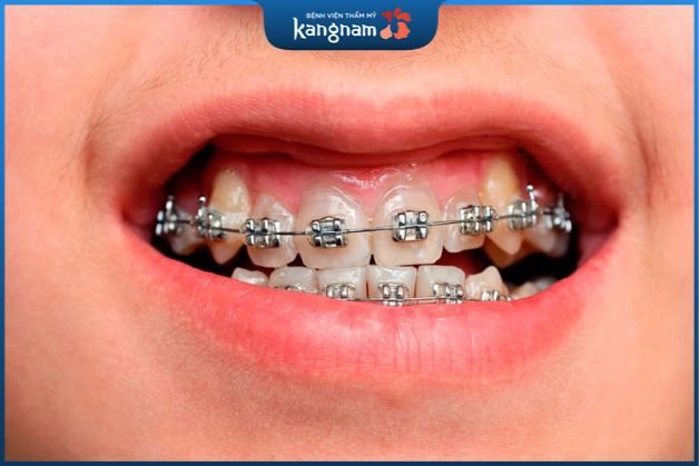 Phương pháp không cần phẫu thuật