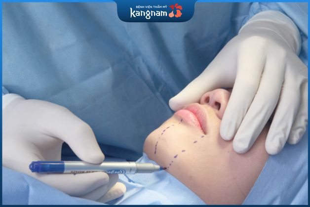 Công nghệ độn cằm hiện đại chuẩn Hàn Quốc