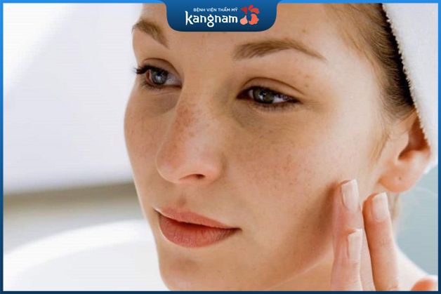 Hỗ trợ điều trị tàn nhang bằng mỹ phẩm