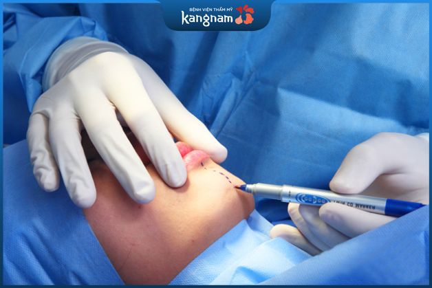 Đo và vẽ dáng cằm