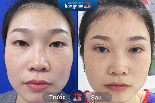 Hồi phục nhanh chóng, không để lại sẹo xấu