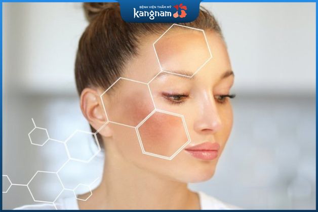 Những lưu ý khi điều trị nám tại nhà