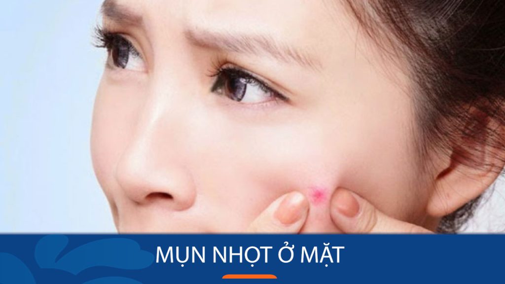 Cách điều trị mụn nhọt ở mặt : Bí quyết loại bỏ mụn nhọt tận gốc, ngăn ngừa sẹo