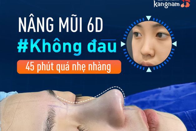 Nâng mũi 6D không đau