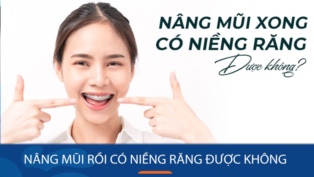Nâng mũi rồi có niềng răng được không? Thời điểm an toàn & lưu ý cần biết