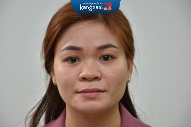 Người cố đầu mũi to bè