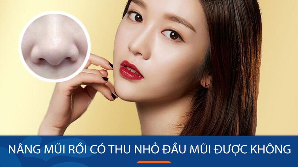 Nâng mũi rồi có thu nhỏ đầu mũi được không? Khi nào làm được & lưu ý an toàn