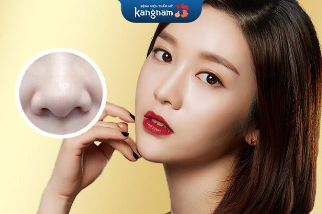 Nâng mũi rồi có thu nhỏ đầu mũi được không