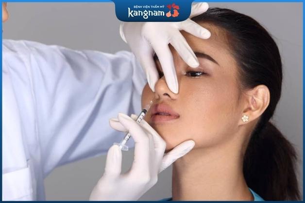 Nâng mũi rồi có tiêm filler được không?