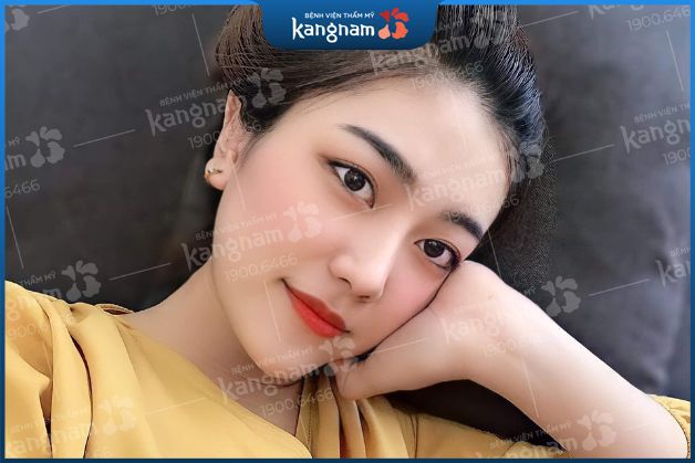 Không biến chứng, không để lại sẹo