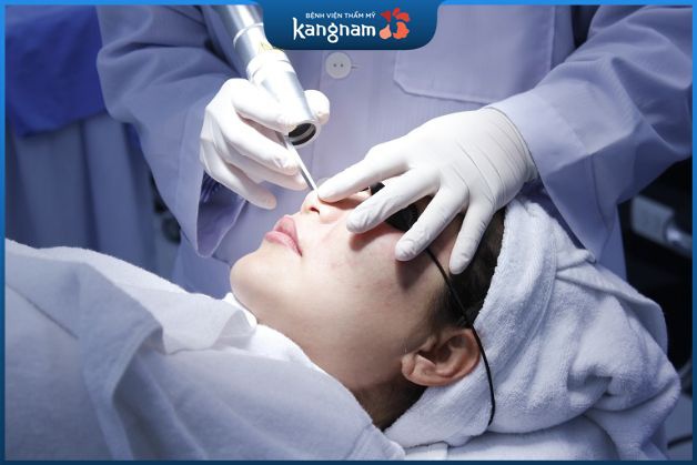 Phẫu thuật lạnh trị tàn nhang hiệu quả