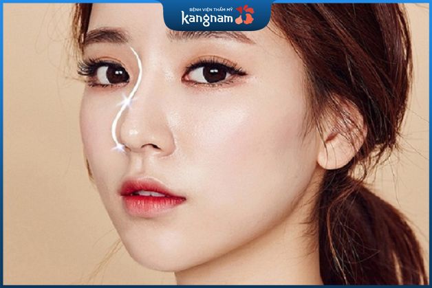 Nâng mũi S line 2 lớp tại sao được tín đồ thẩm mỹ yêu thích